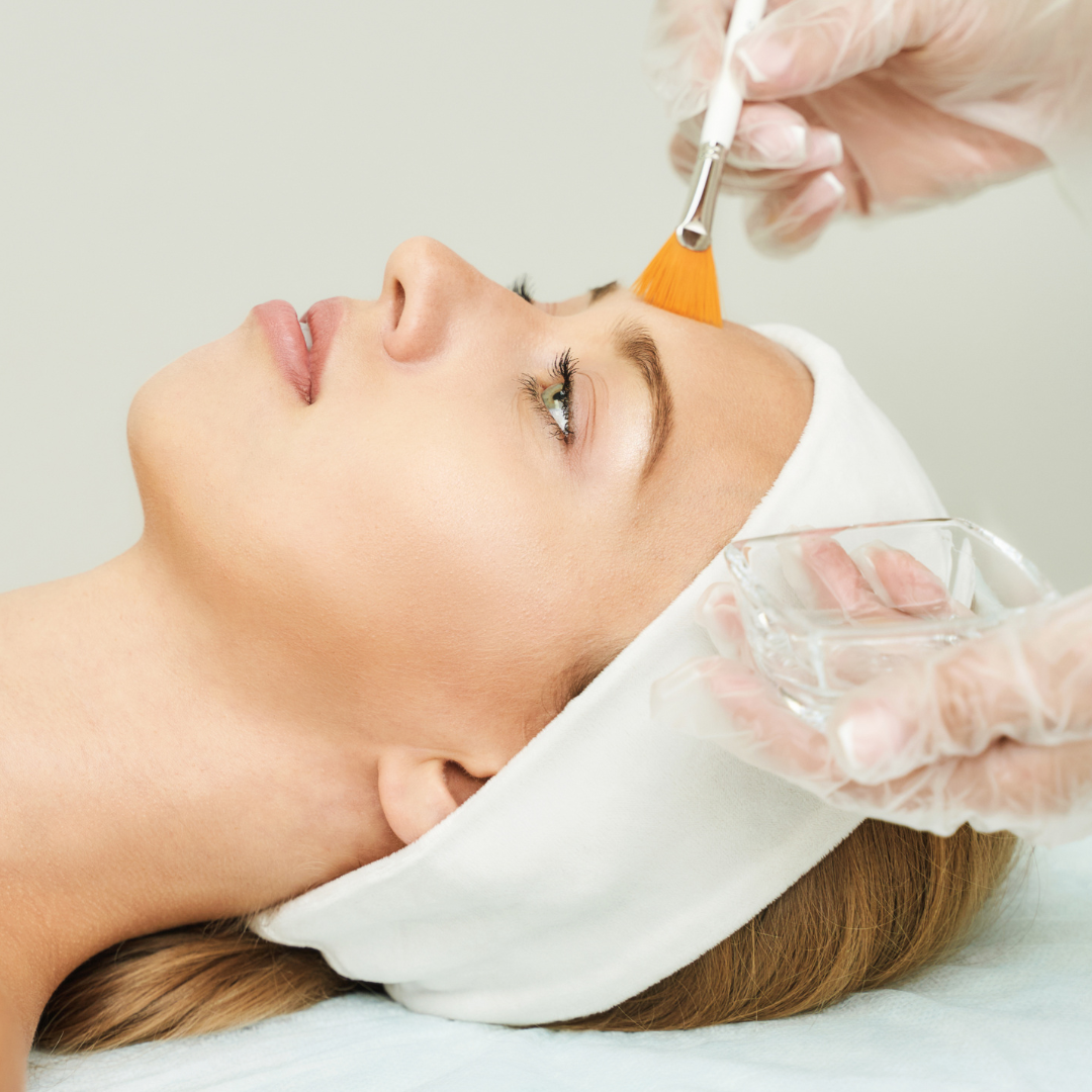 Top 5 Benefits of Peels (And Why You Should Get Them During Winter)