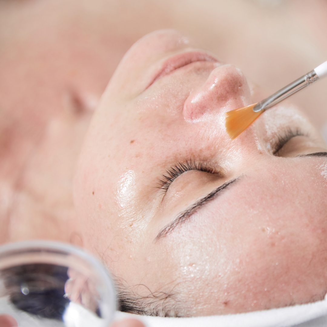 Unlock Radiant Skin with a Peel Treatment