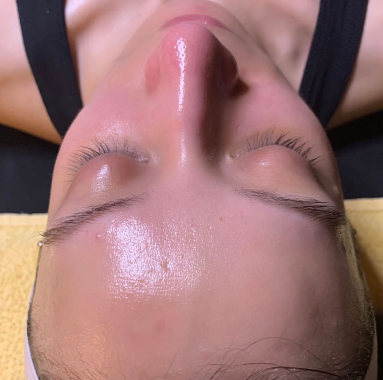 VDM Glow Microdermabrasion